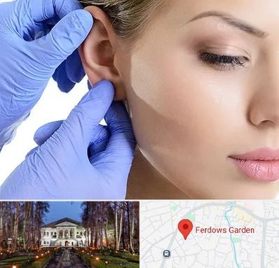 اتوپلاستی در باغ فردوس