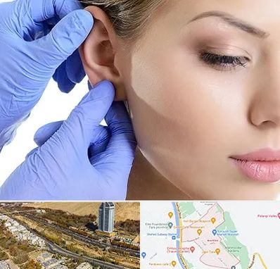 اتوپلاستی در خیابان نیایش شیراز