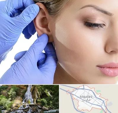 اتوپلاستی در الیگودرز
