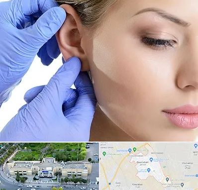 اتوپلاستی در نسیم شهر