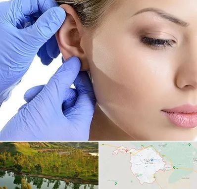 اتوپلاستی در بهبهان