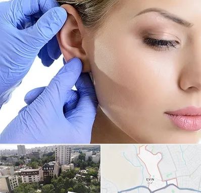 اتوپلاستی در اوین