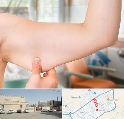 براکیوپلاستی در نواب اسلامشهر