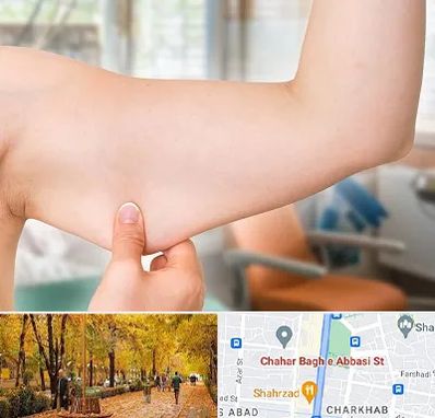 براکیوپلاستی در چهارباغ اصفهان