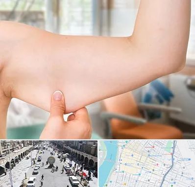 براکیوپلاستی در نادری اهواز