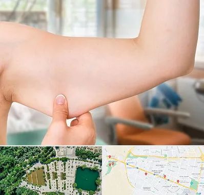 براکیوپلاستی در وکیل آباد مشهد