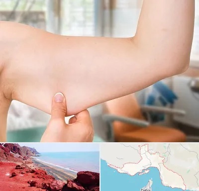 براکیوپلاستی در هرمزگان