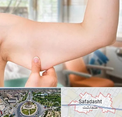 براکیوپلاستی در صفادشت