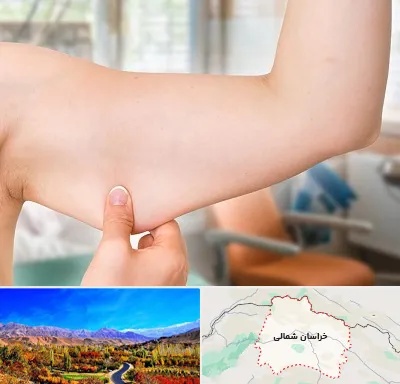 براکیوپلاستی در خراسان شمالی