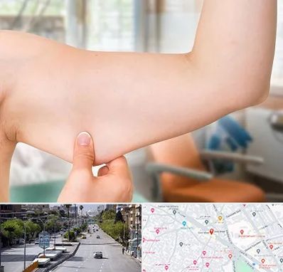 براکیوپلاستی در خیابان زند شیراز