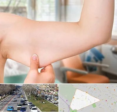 براکیوپلاستی در احمدآباد مشهد