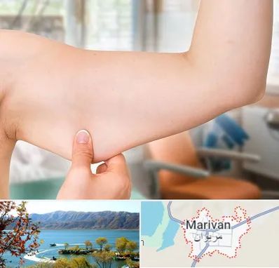 براکیوپلاستی در مریوان
