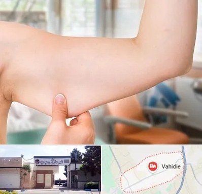 براکیوپلاستی در وحیدیه شهریار