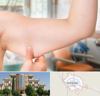 براکیوپلاستی در دهدشت