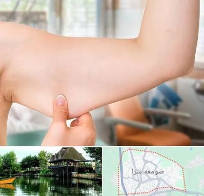 براکیوپلاستی در صومعه سرا