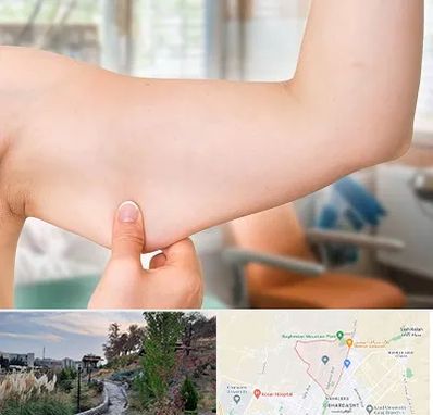 براکیوپلاستی در باغستان کرج