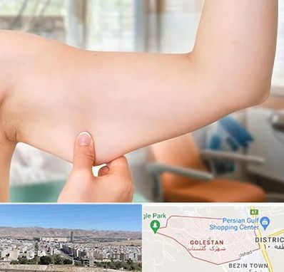 براکیوپلاستی در شهرک گلستان شیراز