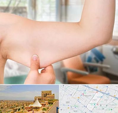 براکیوپلاستی در هاشمیه مشهد