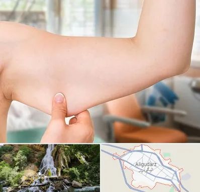 براکیوپلاستی در الیگودرز