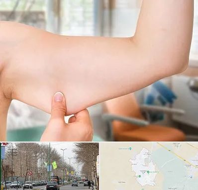 براکیوپلاستی در نظرآباد کرج