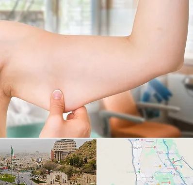 براکیوپلاستی در فرهنگ شهر شیراز