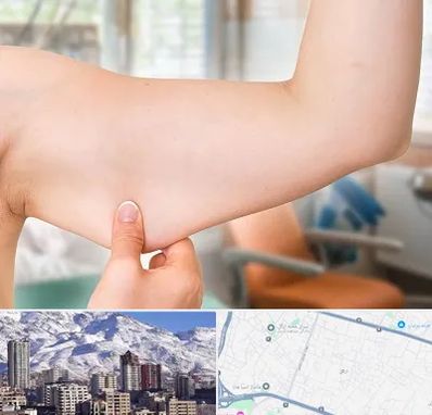 براکیوپلاستی در ازگل