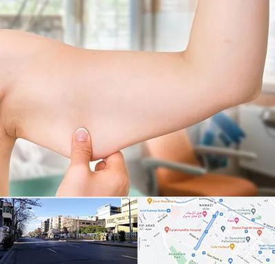 براکیوپلاستی در خیابان ملاصدرا شیراز