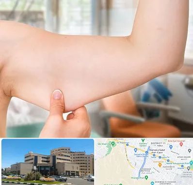 براکیوپلاستی در صیاد شیرازی مشهد