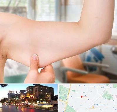 براکیوپلاستی در بلوار سجاد مشهد