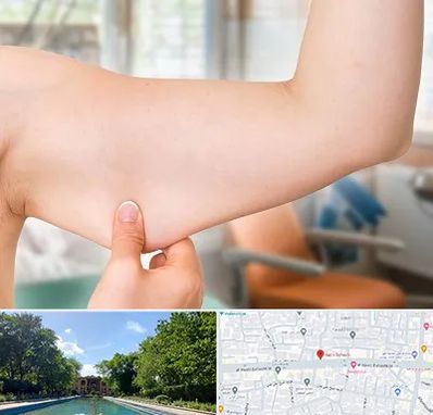 براکیوپلاستی در هشت بهشت اصفهان