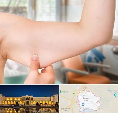 براکیوپلاستی در برازجان