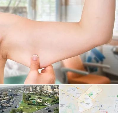 براکیوپلاستی در کمال شهر کرج