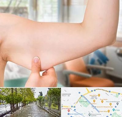 براکیوپلاستی در خیابان ارم شیراز