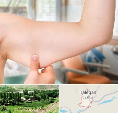 براکیوپلاستی در طالقان