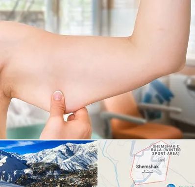 براکیوپلاستی در شمشک