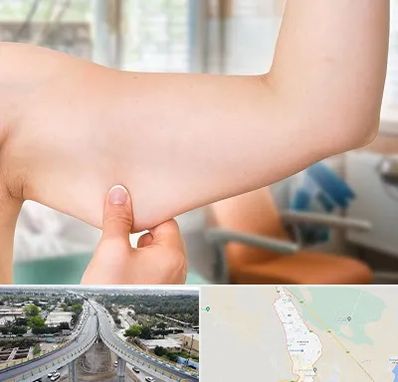 براکیوپلاستی در اندیمشک