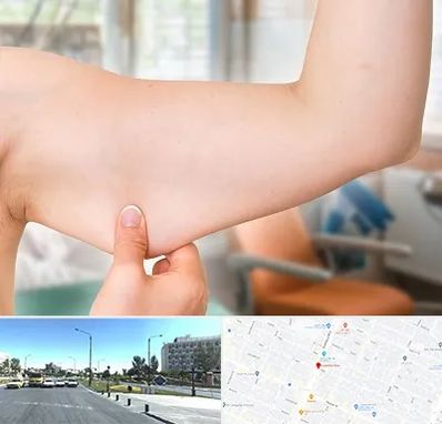 براکیوپلاستی در بلوار کلاهدوز مشهد