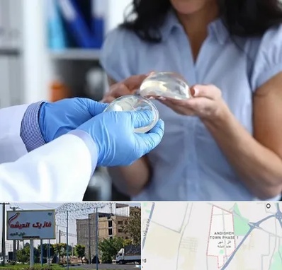 پروتز باسن در فاز یک اندیشه