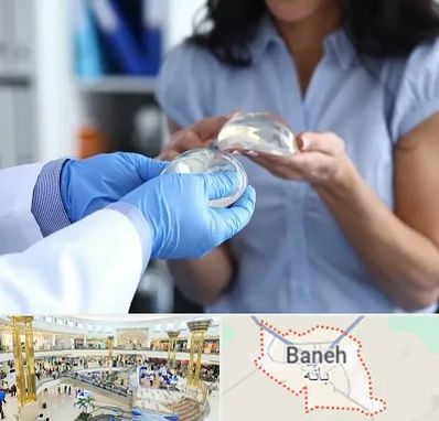 پروتز باسن در بانه