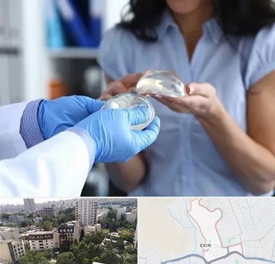 پروتز باسن در اوین