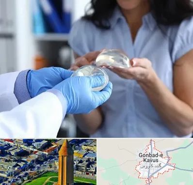 پروتز باسن در گنبد کاووس