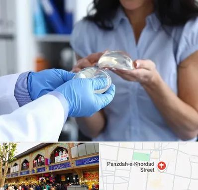 پروتز باسن در 15 خرداد