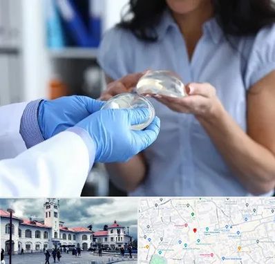 پروتز باسن در میدان شهرداری رشت