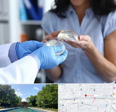 پروتز باسن در هشت بهشت اصفهان