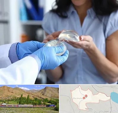 پروتز باسن در خاش