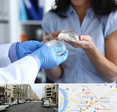 پروتز باسن در زیتون کارمندی اهواز