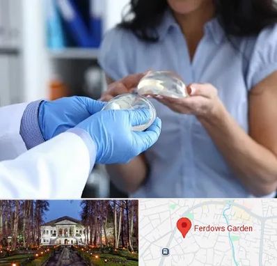 پروتز باسن در باغ فردوس