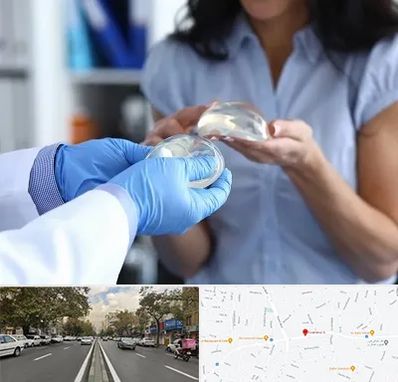 پروتز باسن در دولت