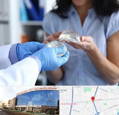 پروتز باسن در نصف راه تبریز