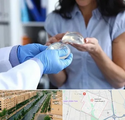 پروتز باسن در فاز سه اندیشه